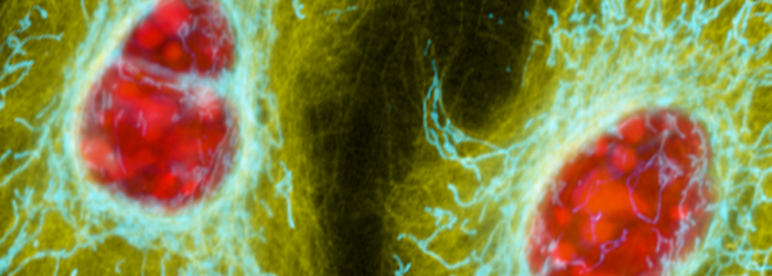 stained-hela-cells