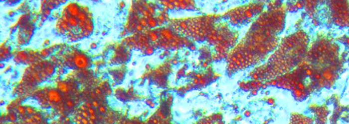 adipose-derived-mesenchymal-stem-cells