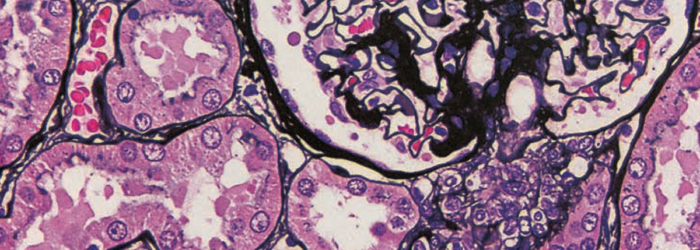 stained-renal-tissue-ventana-medical